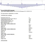 фото 65115-2902012-20 Рессора передняя (11-ти листовая) вит. ушко