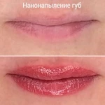 Фото №3 Нанонапыление Бровей. Губ.Межресничка Мушка