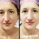 Фото №8 Массаж скульптурный лица и зоны декольте