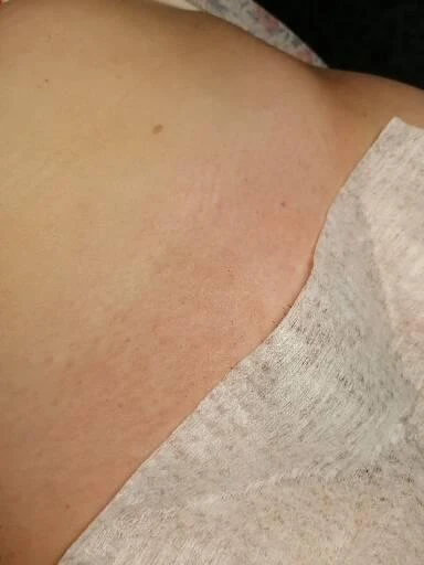 Фото Шугаринг депиляция 