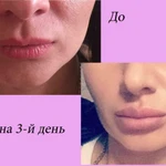 Фото №10 Косметологические услуги