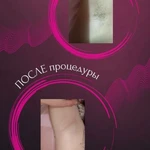 фото Шугаринг и депиляция воском