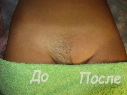 Фото Сахарная эпиляция(шугаринг)и воск