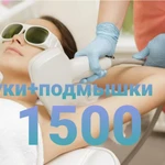 Фото №3 Лазерная эпиляция 