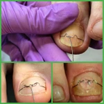 фото Курс «Введение в подологию», 11 дней