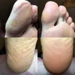 Фото №2 Педикюр 