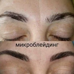 Микроблейдинг