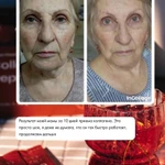 Фото №4 Nl коллаген