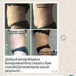 Наращивание ресниц, Наращивание волос,лазерная эпи