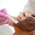 Карбоновый пилинг