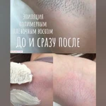 Фото №6 Женская и мужская эпиляция ( депиляция).