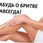 Фотоэпиляция