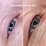 Фото №2 Нанонапыление Бровей. Губ.Межресничка Мушка