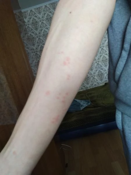 Фото Дезинсекция в Октябрьском, Туймазах и Бавлах !