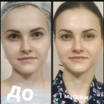 Фото №4 Массаж скульптурный лица и зоны декольте