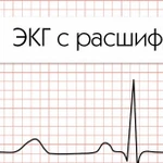 Электрокардиография ЭКГ с расшифровкой круглосуточно