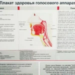 Восстановление речи взрослых при дизартрии