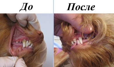 Фото Ультразвуковая чистка зубов