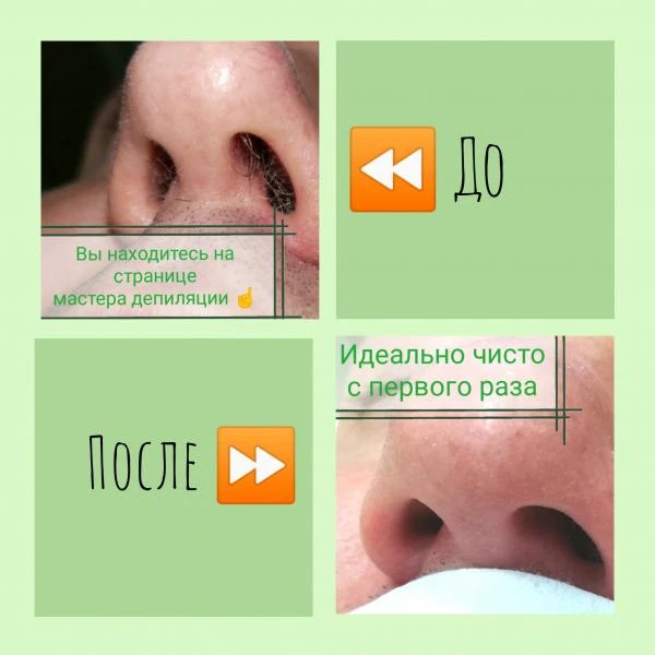 Фото Депиляция. Косметология.