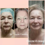 Фото №9 Косметолог 