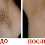 Фото №3 Депиляция (воск)