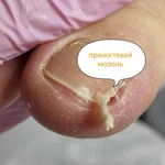 Фото №5 Подолог Ялта
