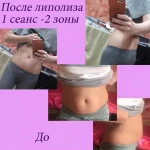 Фото №6 Косметологические услуги