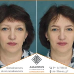 Фото №4 Художественное оформление бровей