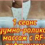 Кавитация и RF - лифтинг