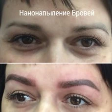 Фото Нанонапыление Бровей. Губ.Межресничка Мушка