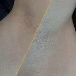 Фото №2 Шугаринг Курчатов