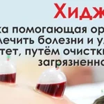 ХИДЖАМА в Ростове-на-Дону или выезд. звоните