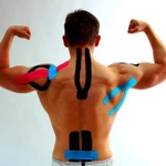 Кинезиотейпирование