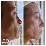 Фото №2 Nl коллаген