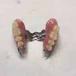 Зубной техник ремонт зубных протезов