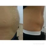 Фото №4 Косметолог / Чистка лица/ Пилинг/Мезопилинг