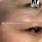 Фото №4 Косметолог- эстетист
