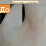 Фото №4 Шугаринг Курчатов