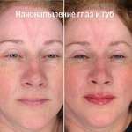 Фото №4 Нанонапыление Бровей. Губ.Межресничка Мушка