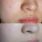 Эффект тонального крема BB glow