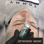 Фото №2 Массаж косметолог 