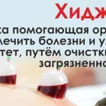 Хиджама
