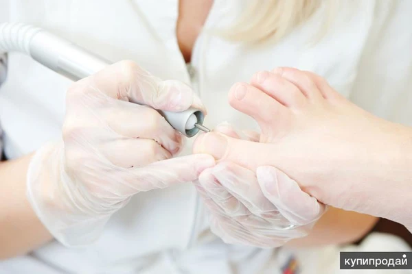 Фото Подолог. Профессиональная обработка стопы любой сложности.