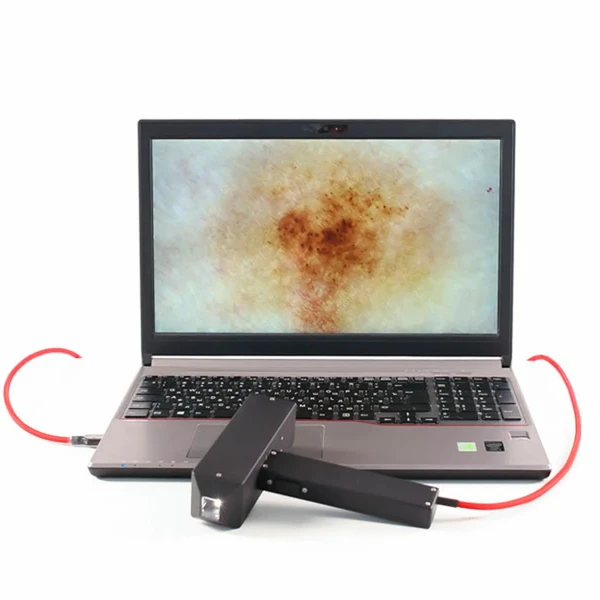 Фото Компьютерный дерматоскоп РДС-3