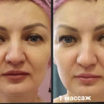 Фото №7 Массаж скульптурный лица и зоны декольте