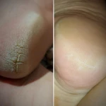 Фото №6 Педикюр