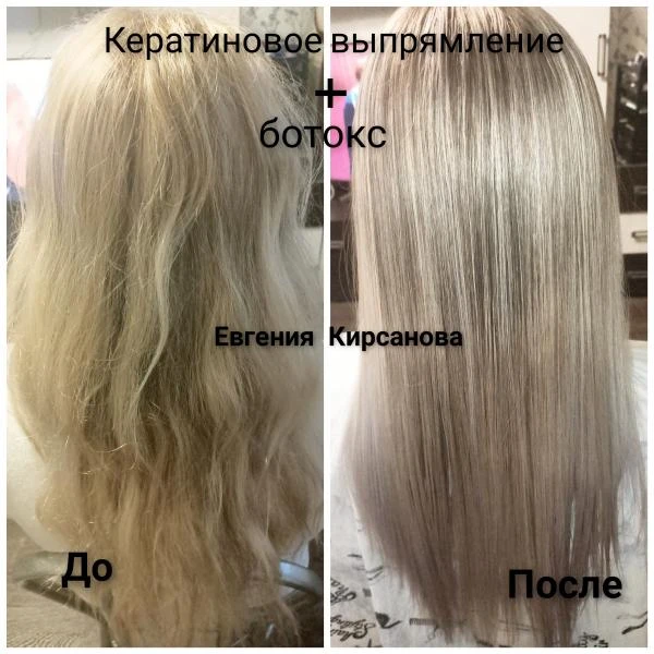 Фото Ботокс 