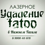 Лазерное удаление тату и татуажа