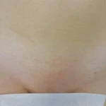 Фото №2 Женская и мужская эпиляция ( депиляция).
