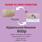 Фото №5 Шугаринг депиляция Феодосия
